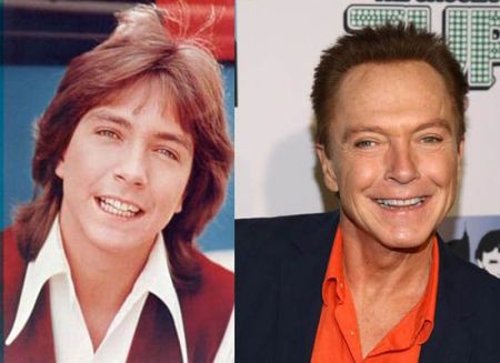 David Cassidy Plastic Surgery