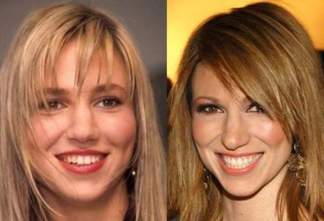 Debbie Gibson Plastic SurgeryDebbie Gibson Plastic Surgery