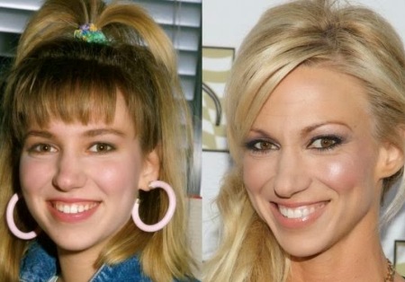 Debbie Gibson Plastic SurgeryDebbie Gibson Plastic Surgery