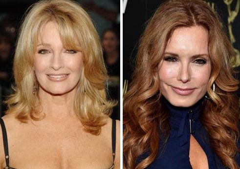 Deidre Hall Plastic Surgery