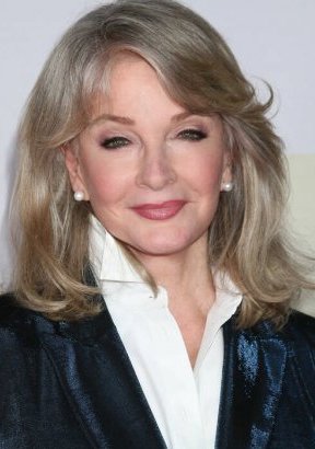 Deidre Hall Plastic Surgery