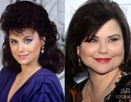 Delta Burke Plastic Surgery