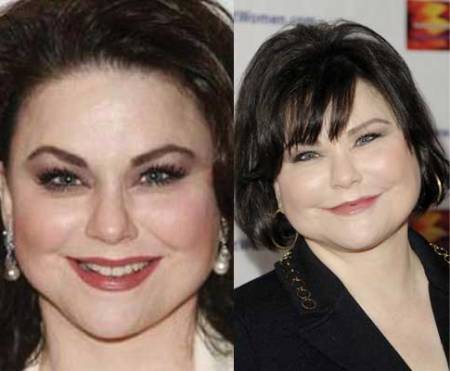 Delta Burke Plastic Surgery