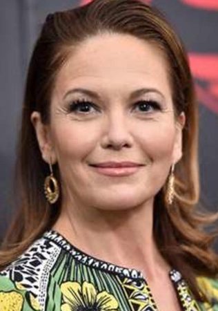 Diane Lane Plastic Surgery