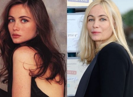 Emmanuelle Beart Plastic Surgery