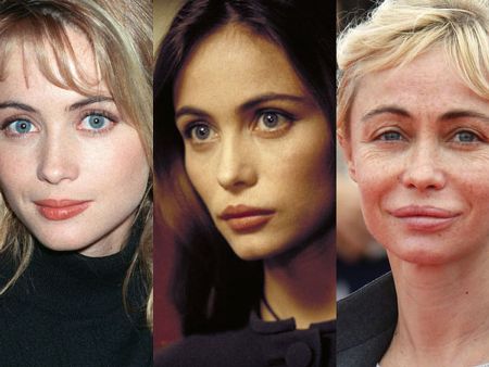 Emmanuelle Beart Plastic Surgery