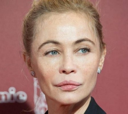 Emmanuelle Beart Plastic Surgery