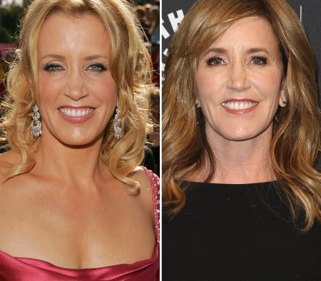 Felicity Huffman Plastic Surgery