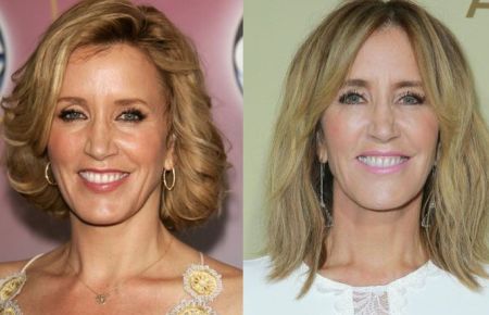 Felicity Huffman Plastic Surgery