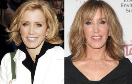 Felicity Huffman Plastic Surgery