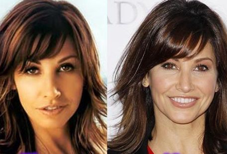 Gina Gershon Plastic Surgery