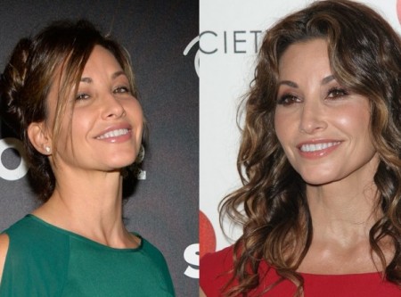 Gina Gershon Plastic Surgery