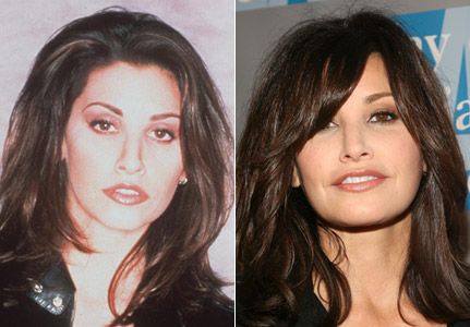 Gina Gershon Plastic Surgery