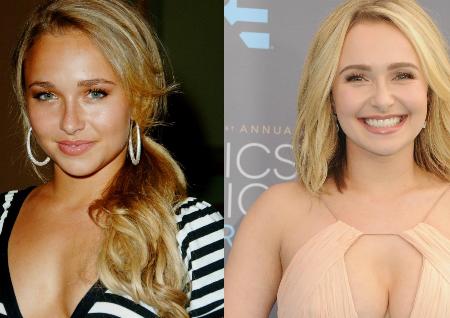 Hayden Panettiere Implants