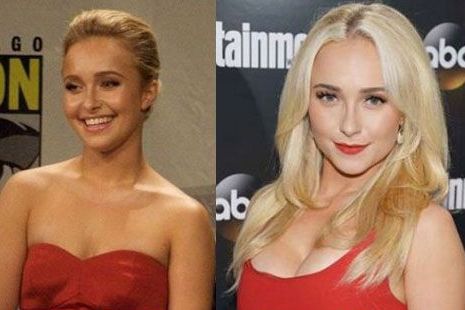 Hayden Panettiere Implants