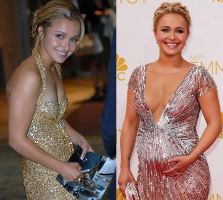 Hayden Panettiere Implants