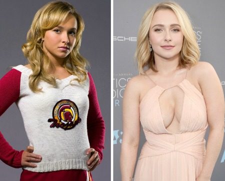 Hayden Panettiere Implants