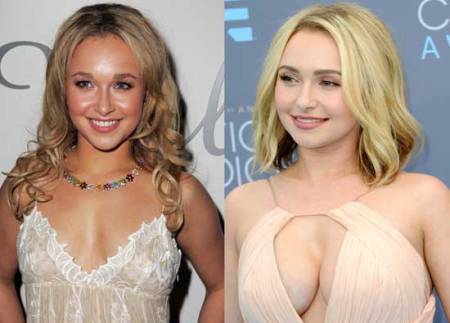 Hayden Panettiere Implants