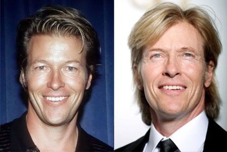 Jack Wagner Plastic Surgery