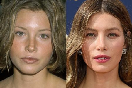 Jessica Biel Nose Job