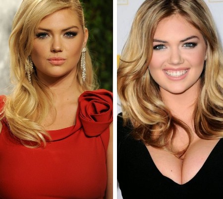 Kate Upton Plastic Surgery