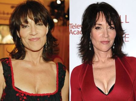 Katey Sagal Plastic Surgery