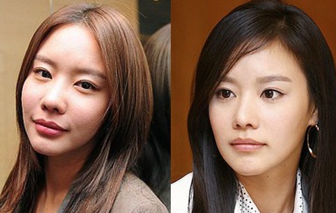 Kim Ah Joong Plastic Surgery