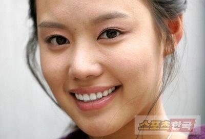 Kim Ah Joong Plastic Surgery