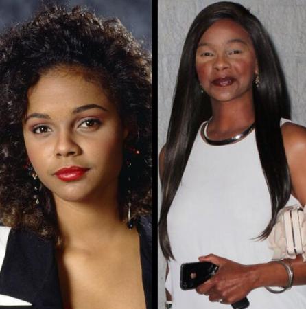 Lark Voorhies Plastic Surgery