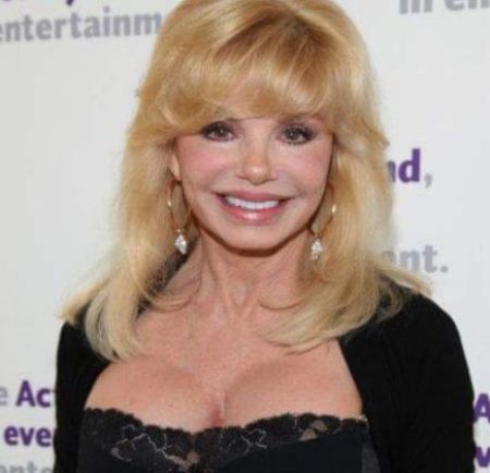 Loni Anderson Plastic Surgery