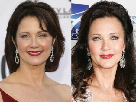 Lynda Carter Plastic Surgery