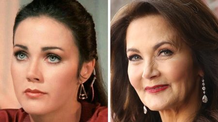 Lynda Carter Plastic Surgery