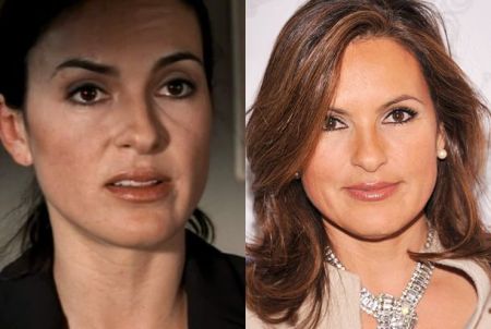 Mariska Hargitay Plastic Surgery