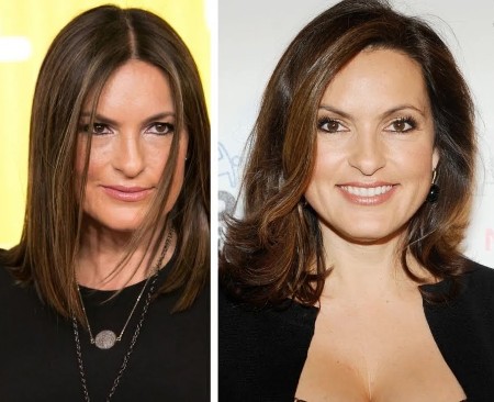 Mariska Hargitay Plastic Surgery