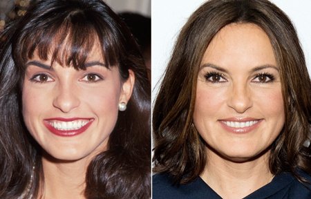 Mariska Hargitay Plastic Surgery