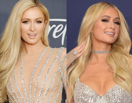 Paris Hilton Breast Implants