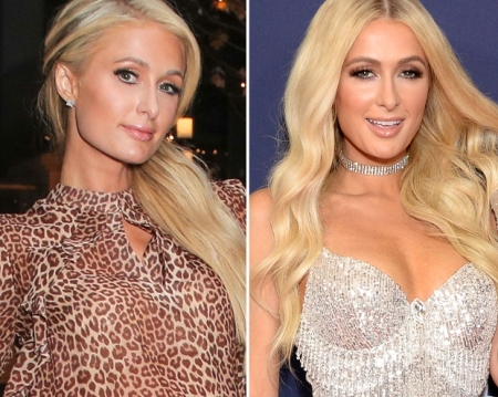 Paris Hilton Breast Implants