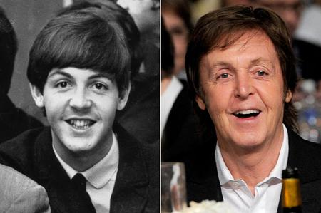 Paul Mccartney Plastic Surgery