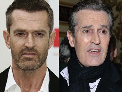 Rupert Everett Plastic Surgery