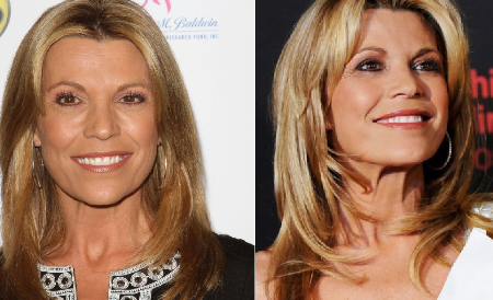 Vanna White Plastic Surgery