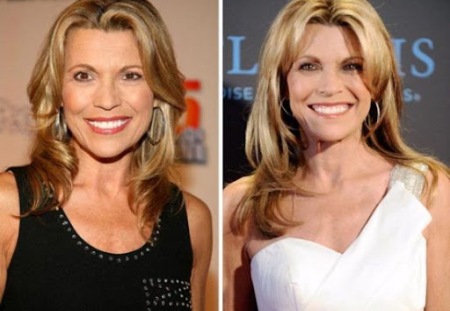 Vanna White Plastic Surgery