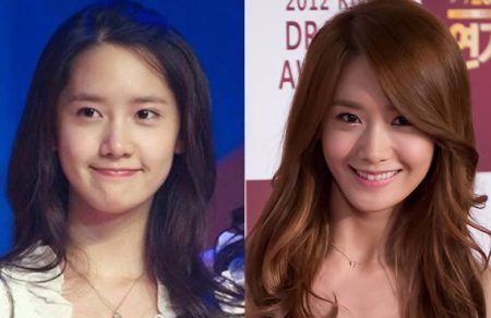 Yoona Plastic Surgery