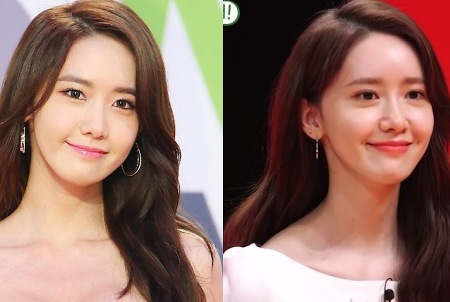 Yoona Plastic Surgery