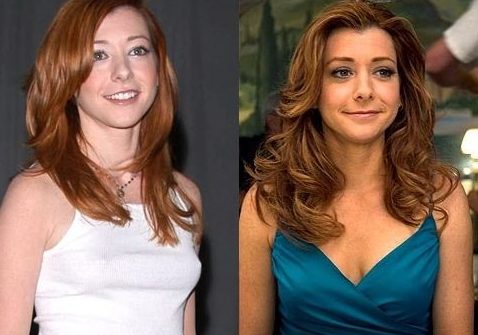 Alyson Hannigan Plastic Surgery