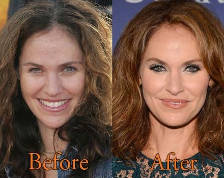 Amy Brenneman Plastic Surgery