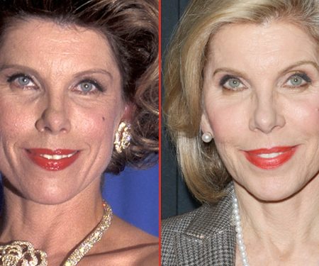 Christine Baranski Plastic Surgery