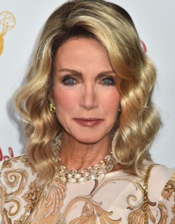 Donna Mills Plastic Surgery