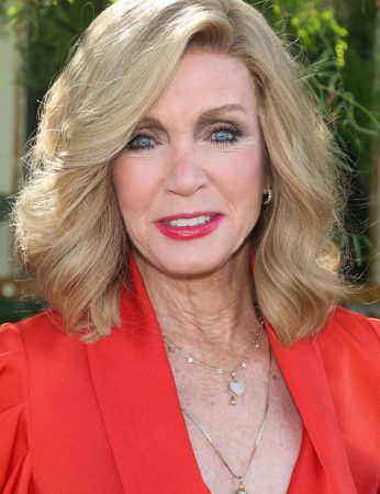 Donna Mills Plastic Surgery