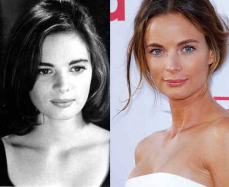 Gabrielle Anwar Plastic Surgery