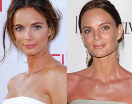 Gabrielle Anwar Plastic Surgery